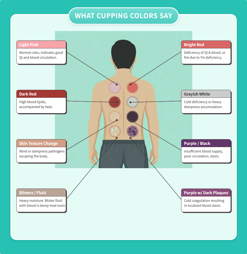 Cupping Color Chart and meaning